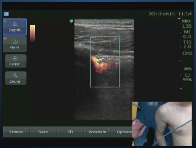case1 img3